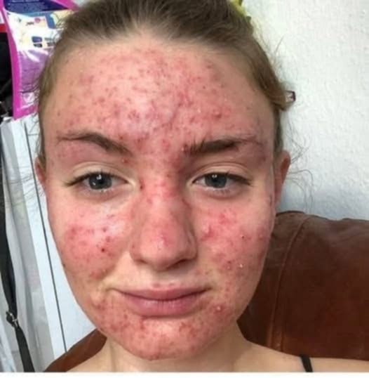 His body was itchy, he thought it was an allergy