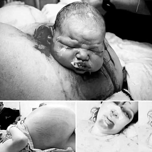 Mother gives birth in the middle of…see more  