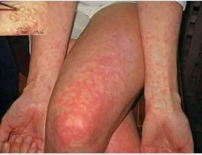These are the signs that he is cr… See more